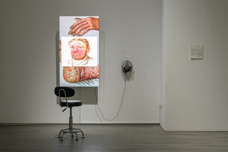 MUNUS–免疫與社群的當代治癒術｜吳虹霏｜國藝會補助成果檔案庫